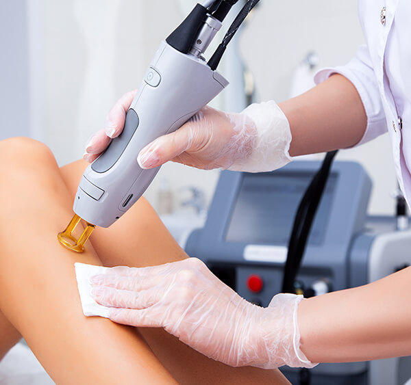 Photo of a laser treatment