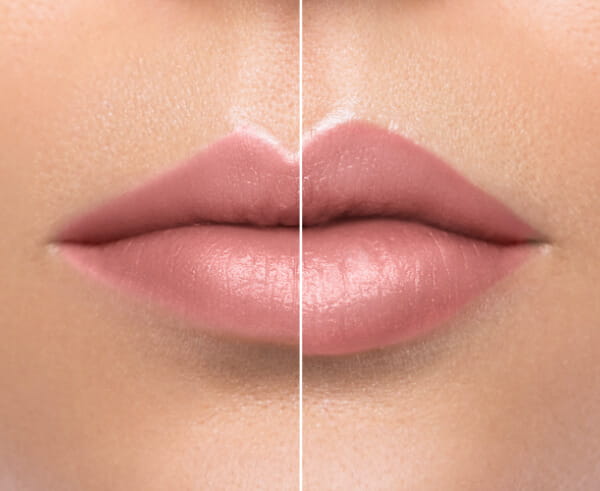 Photo of a lips